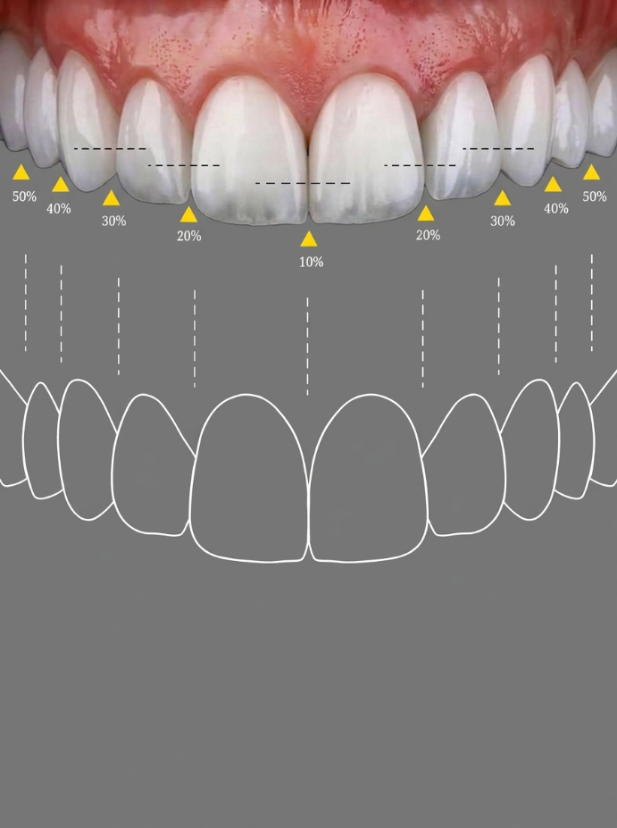 Smile Design / Smile Makeover